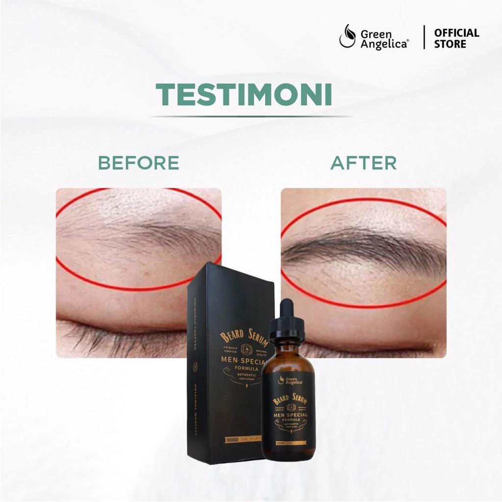 Green Angelica Beard Serum 20 ml - Beard, Mustache, Sideburn & Eyebrow Growth Serum - BPOM Certified