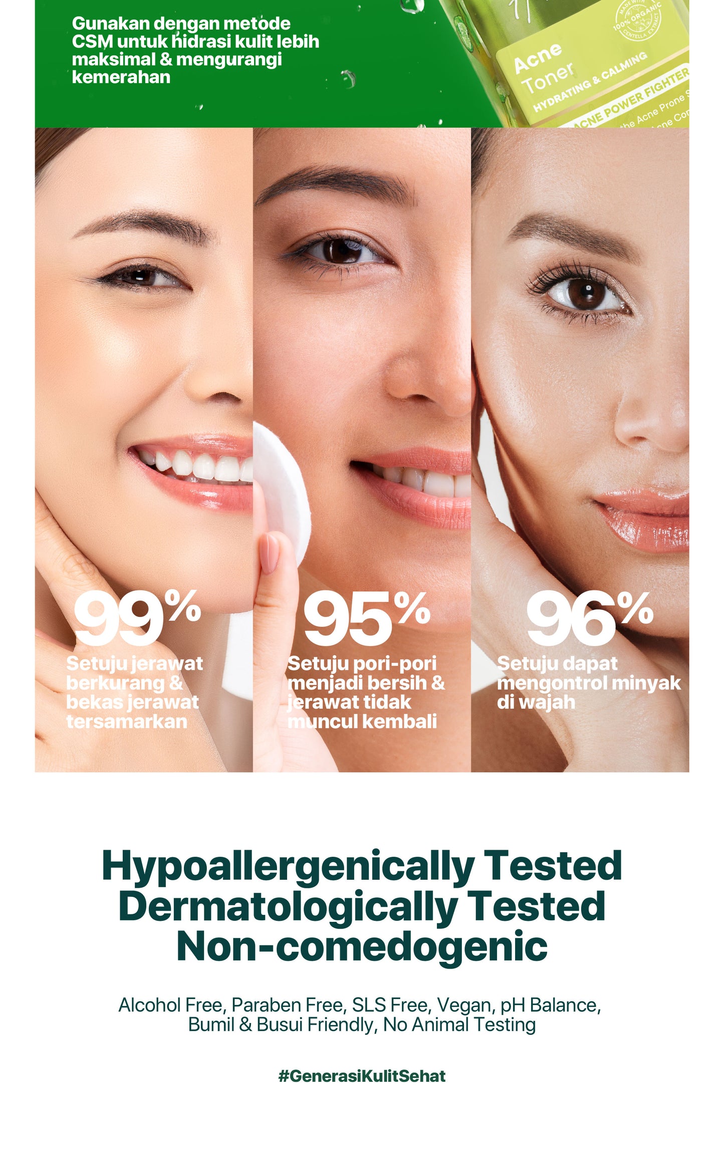 NPURE Cica Hydrating Acne Toner 150 ml / Hydrating Toner / Acne Toner / Toner Kulit Jerawat Berminyak / Mencerahkan / Beruntusan