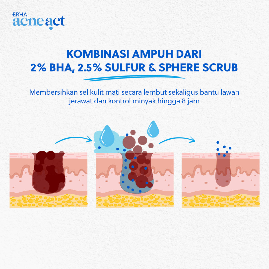 ERHA Acneact ACSBP (Acne Cleanser Scrub Beta Plus) 60g - Sabun Wajah Scrub Kulit Jerawat BHA Sulfur