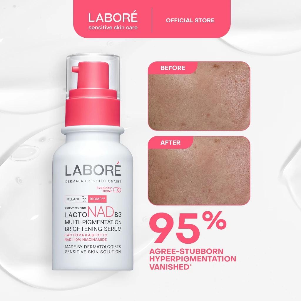 NEW! LABORE Multi-Pigmentation Brightening Serum - Brightening Serum for the Face to Treat Dark Spots and Acne Scars