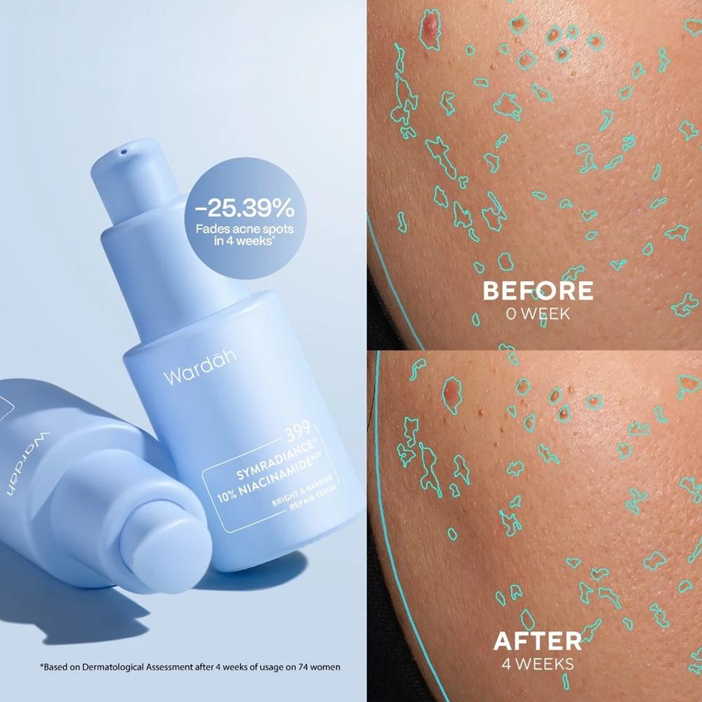 WARDAH Funtastic Duo Bundle – Moisturizer + Serum | Crystal Secret | SymWhite | Renew You