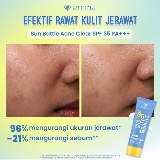 Emina Sun Battle SPF35 PA+++ – Acne Clear Sunscreen with CICA & Allantoin, 50ml