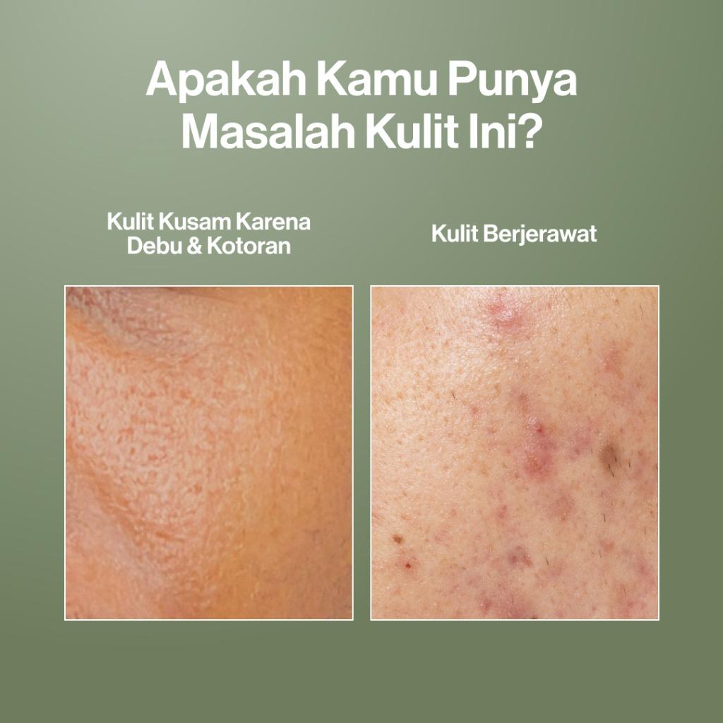 Kahf Acne & Pore Cleanse Scrub - Deep Clean & Oil Control for Men 100ml with Centella Asiatica Salicylic Acid Allantoin Pentavitin