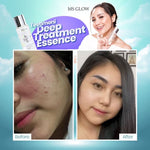 Ms glow DEEP TREATMENT ESSENCE