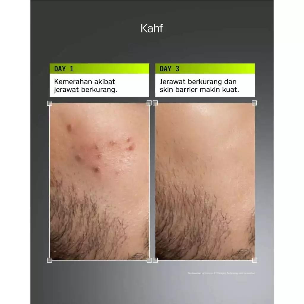 Kahf Acne Care Amino Gel Face Wash 100ml – Gentle Cleanser for Men’s Acne & Sensitive Skin
