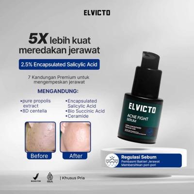 Elvicto Men’s Acne Fight Face Serum 20ml | Controls Oil, Clears Acne, Soothes Irritation