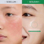 Lumixpert B5 Centella Barrier Relief Moisturizer Gel Barrier Rescue  Instant Soothing Boosting