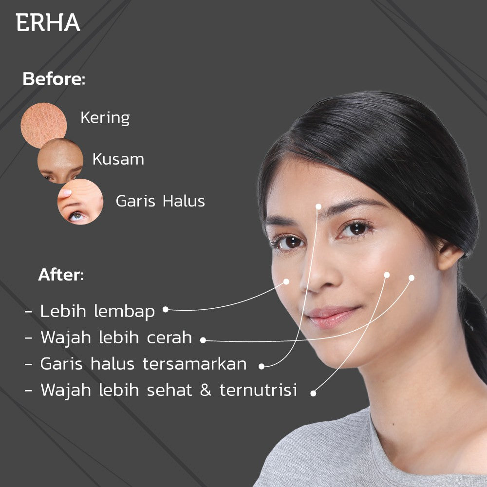 ERHA Essential Moisturizer 30g - Pelembab Wajah Anti Penuaan Untuk Semua Jenis Kulit