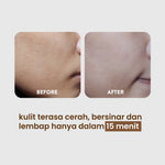 NPURE Sheet Mask Licorice / Ultra Light Complete / Brightening Sheet Mask / Masker Wajah Cerah Glowing /  5X Bright Boost