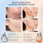 PREMIERE BEAUTE Whitening Serum 30ml  Niacinamide Centella Luminous White Glow Brightening Serum Kulit Kusam Noda Hitam Bekas Jerawat Eksfoliasi Brightening Serum serum wajah glowing dan putih untuk Kulit Kenyal HalusBebas Jerawat dan Tampak Mud