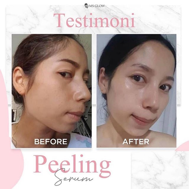 MS glow Peeling serum