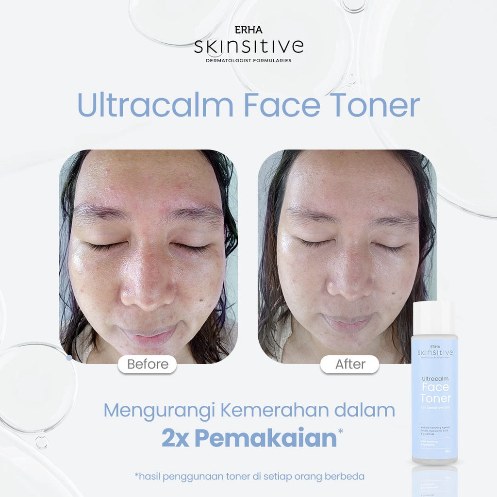 ERHA Bundle Skinsitive Ultracalm Face Wash 80g + Ultracalm Face Toner 100ml - Paket Kulit Wajah Sensitif & Aman untuk Semua Jenis Kulit