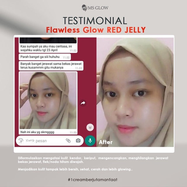 Red jelly MS glow