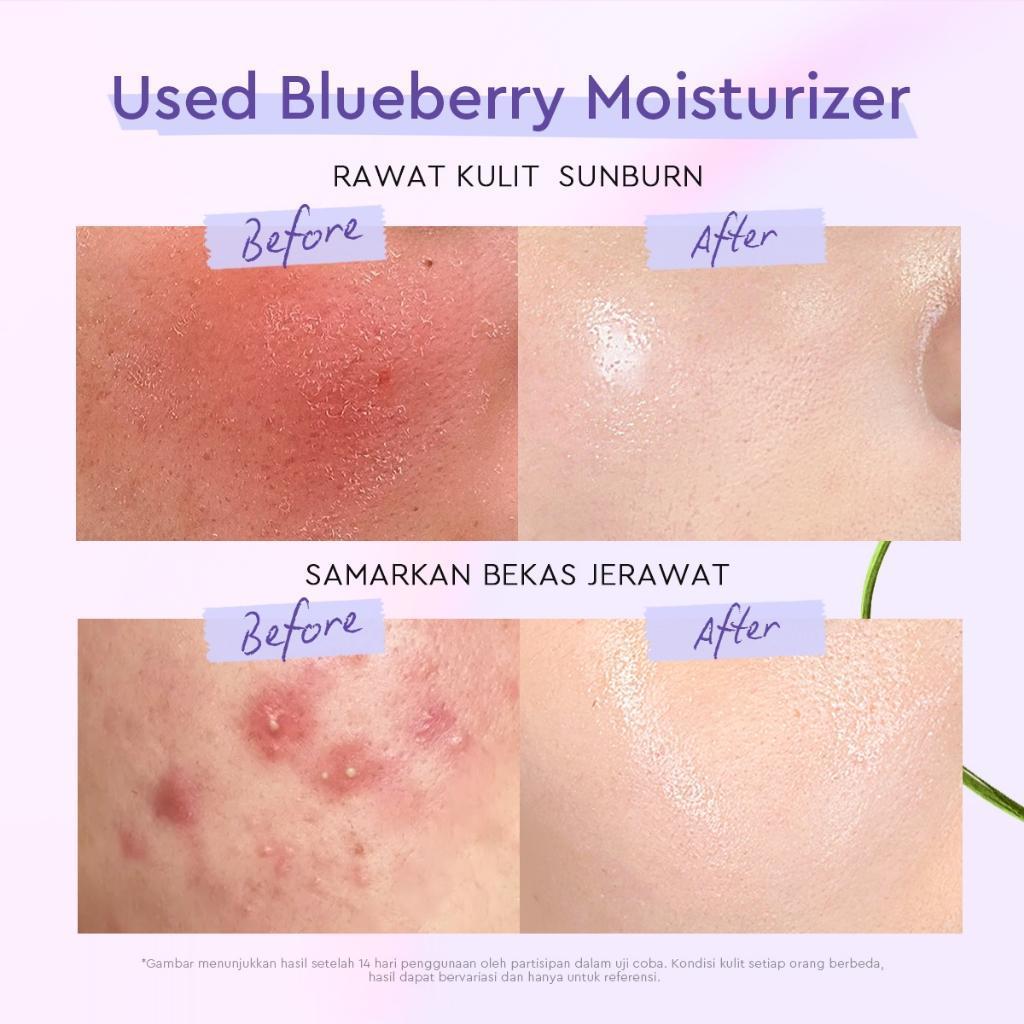 Glad2Glow 5% Ceramide Moisturizer Blueberry 30g - Barrier Boosting Hydration for Dry Flaky Irritated Skin with Blueberry Extract & Ceramide Complex