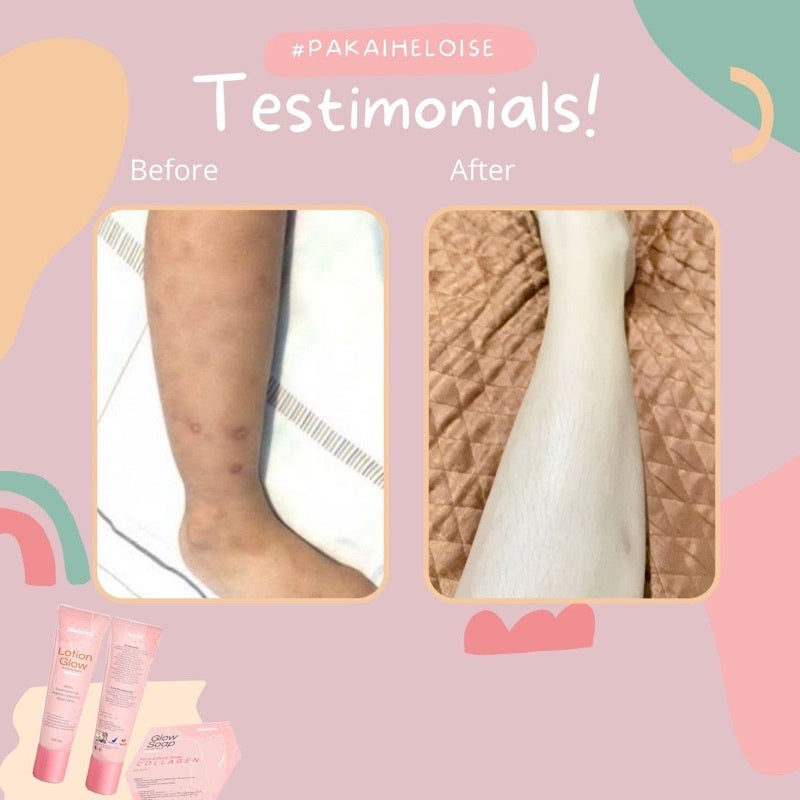 Paket Super Brightening Jerawat punggung & Bekas Luka Heloise Beauty (lotion glow + glow soap collagen) BPOM
