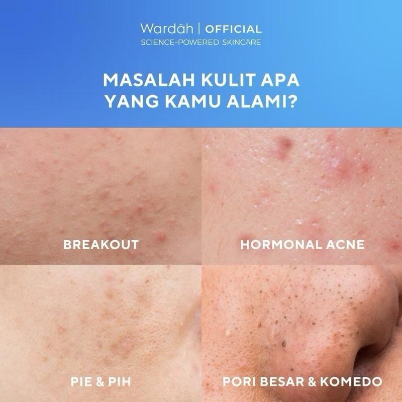 Wardah UV Shield Acne Calming New Pack!