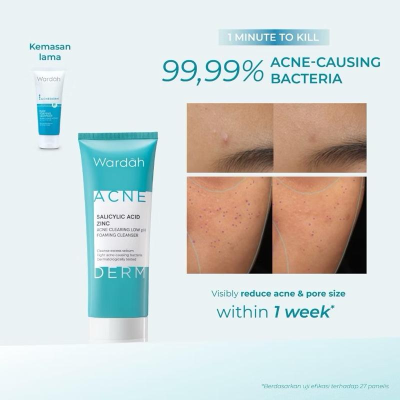 Wardah Acnederm DuoFoam – Acne-Fighting Cleanser (50mL & 100mL)