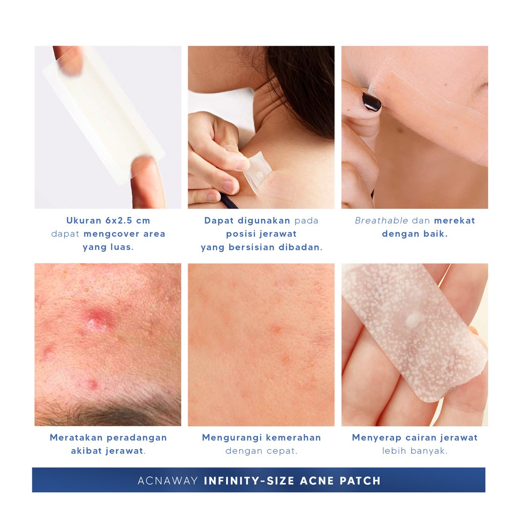 ACNAWAY Infinity Acne Patch – Acne Patch Ukuran Besar 6x2.5cm untuk Jerawat | Breathable, Tipis & Sweatproof | Plester Jerawat Tempel dengan Salicylic Acid + Centella + Mugwort
