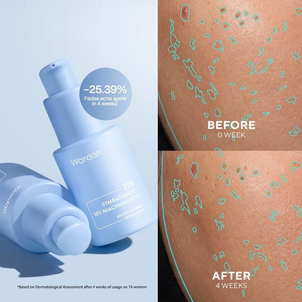 WARDAH Funtastic Duo Bundle – Moisturizer + Serum | Crystal Secret | SymWhite | Renew You