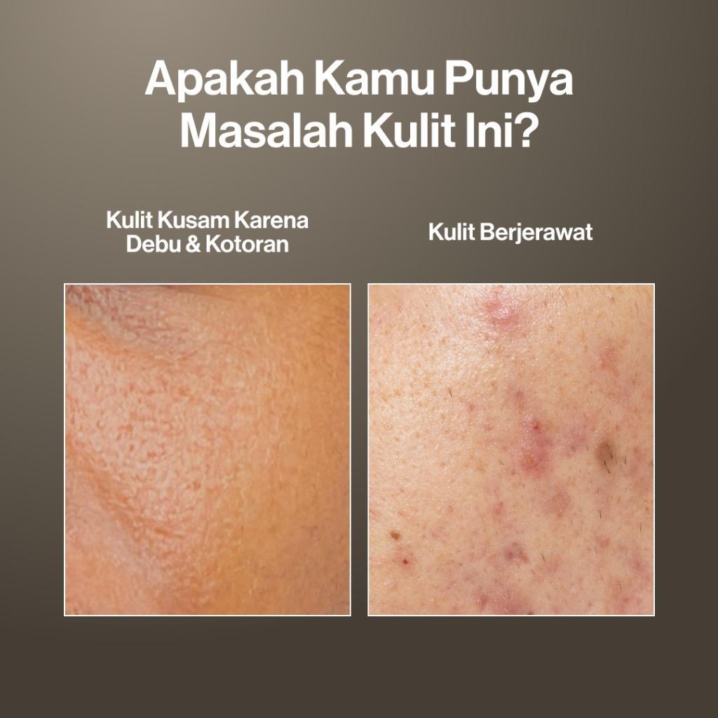 Kahf Men's Brightening Face Wash & Scrub - Fights Dark Spots Acne Marks - 100ml - Bebas Jerawat Dalam 7 Hari - Gentle Exfoliation & Deep Cleansing