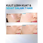 Lumixpert 10x Ceramide Barrier Moisturizer Gel Ceramide & Barrier Actives Menjaga Skin Barrier Perawatan Wajah Mencerahkan wajah Menjaga kelembapan kulit