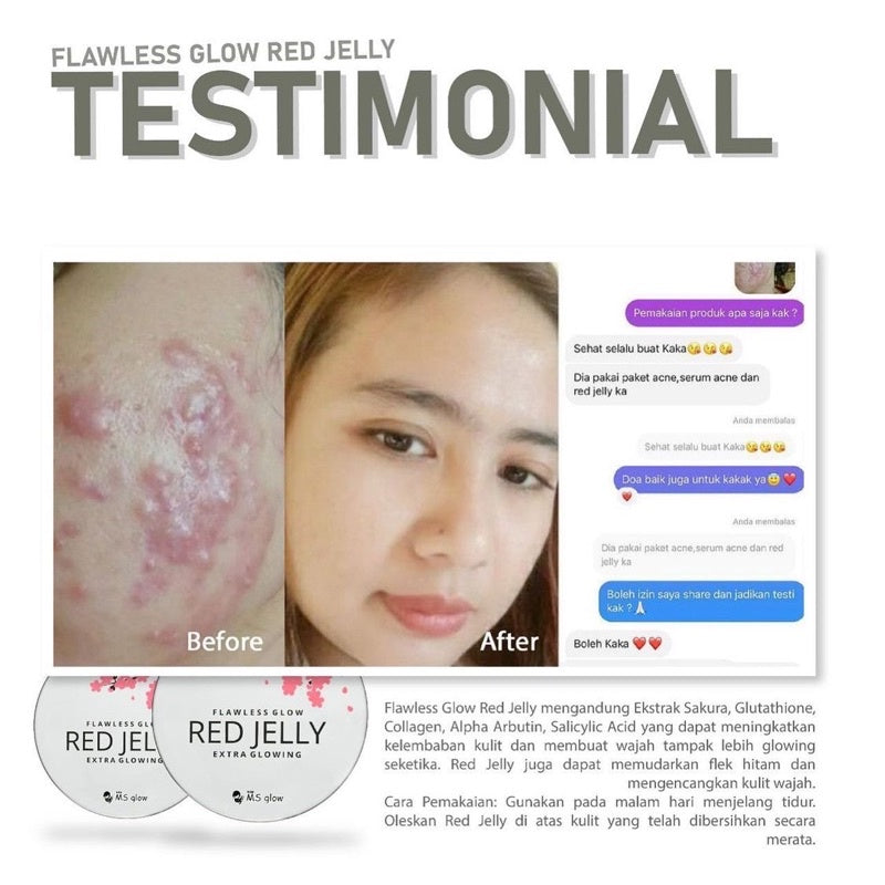 Red jelly MS glow