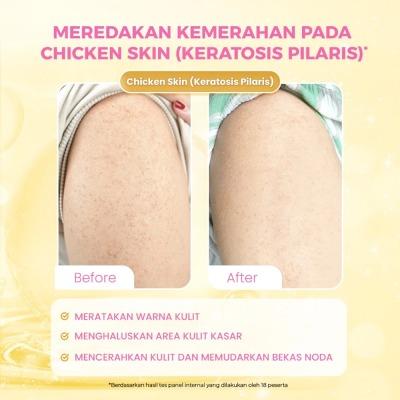 carlett Whitening Intense Brightening Body Serum – 5% AHA BHA PHA 120ml | Exfoliate, Brighten & Smooth Your Skin with Gentle Acids | Glow-Boosting Body Care