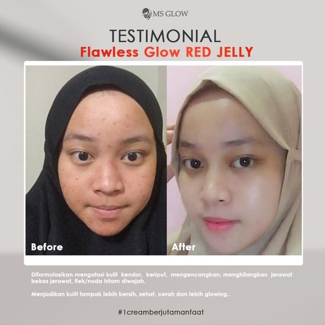 Red jelly MS glow