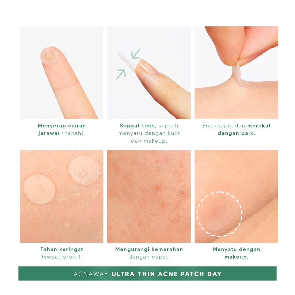 ACNAWAY Ultra Thin Acne Patch – Pimple Patch Tipis untuk Jerawat, Tahan Keringat & Bisa Dipakai di Bawah Makeup | Acne Sticker Salicylic Acid + Tea Tree + Centella Asiatica | Skincare Jerawat Tempel
