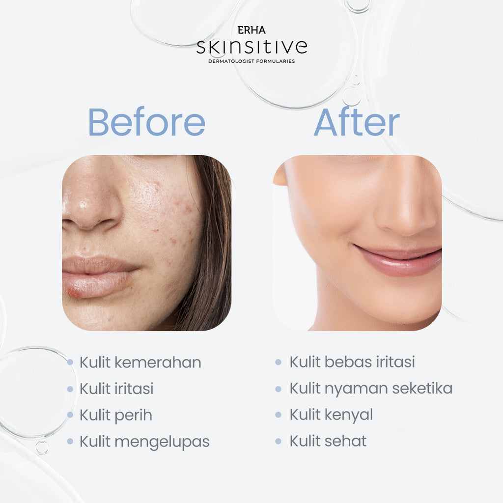 ERHA Bundle Skinsitive Ultracalm Face Wash 80g + Ultracalm Face Toner 100ml - Paket Kulit Wajah Sensitif & Aman untuk Semua Jenis Kulit