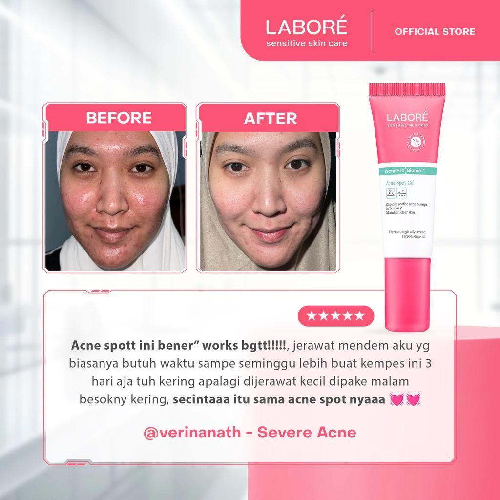 Labore AcnePro Biome Acne Spot Gel 15ml - Facial Treatment for Acne-Prone Skin with Salicylic Acid and Retinol