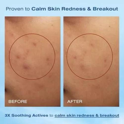 Wardah UV Shield Physical Sunscreen Serum SPF 50+ PA++++ – 30ml Broad Spectrum Protection