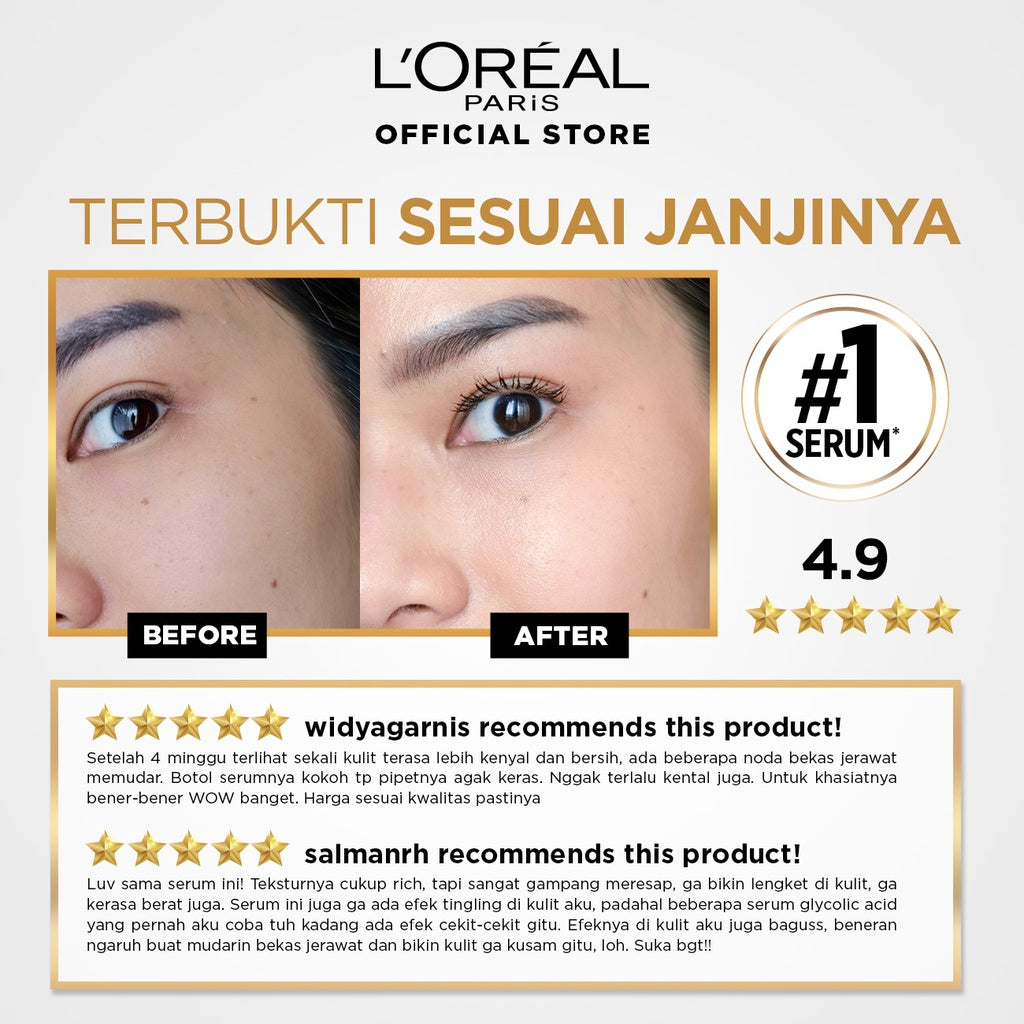 L’Oreal Paris Glycolic Bright Glowing 4 Pcs Skincare Kit Untuk Mencerahkan: Serum, Moisturizer, Facial Wash AHA Glycolic Acid Peeling Brightening Loreal