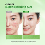 Lumixpert 2% Salicylic Acid Centella Intensive Acne Serum 20ml Mengurangi jerawat dan noda bekas jerawat Menenangkan kulit yang teriritasi