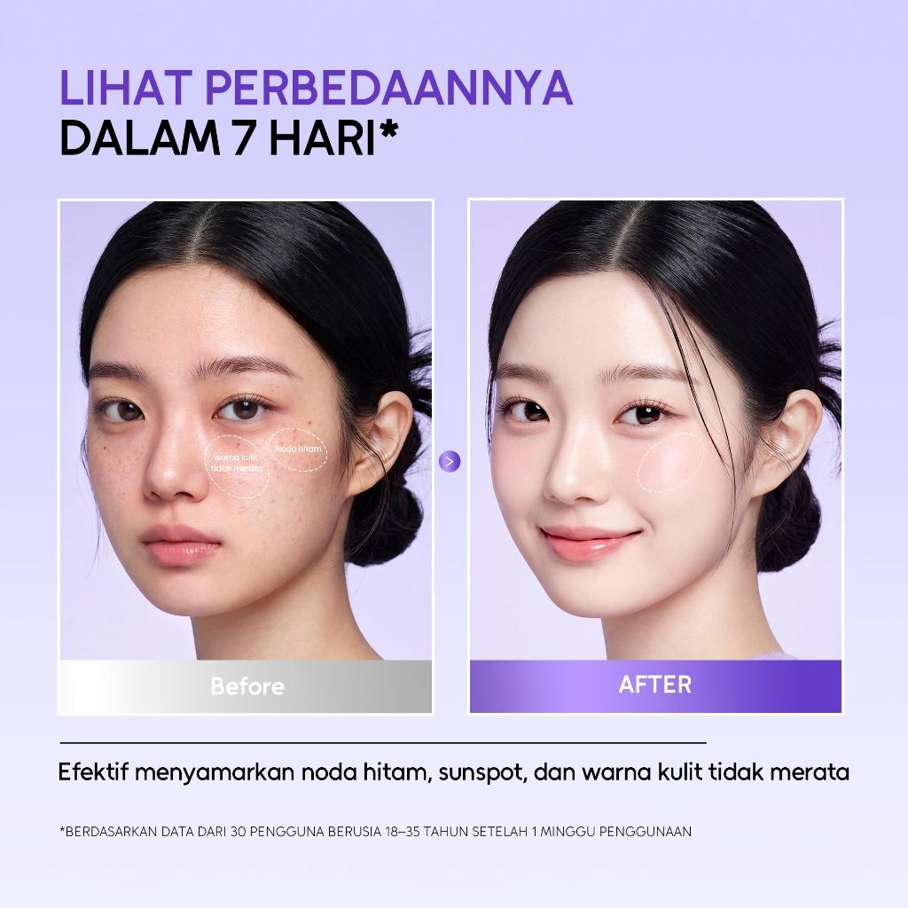 Lumixpert 377 Nicianamide Dark Spot Serum 20ml Menyamarkan noda hitam dan bekas jerawat Meratakan warna kulit dan mengurangi kusam