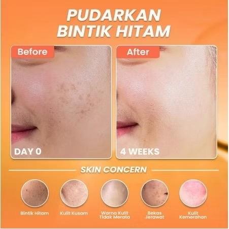 Hanasui GlowBurst C+ Antioxidant Serum – 20ml Radiance Elixir