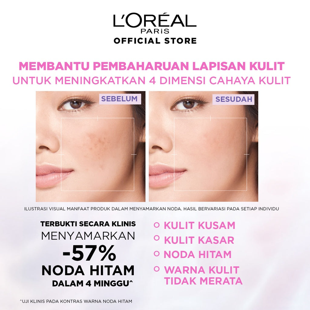 L’Oreal Paris Glycolic Bright Skincare Kit 3 Pcs 15ml – Serum, Day and Night Moisturizer AHA Glycolic Acid Peeling Brightening Untuk Melembabkan dan Mencerahkan Loreal