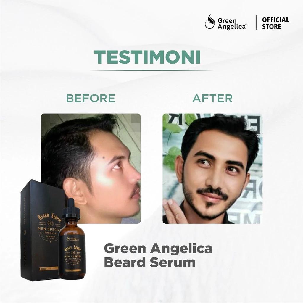 Green Angelica Beard Serum 20 ml - Beard, Mustache, Sideburn & Eyebrow Growth Serum - BPOM Certified