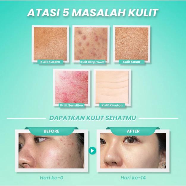 Hanasui Moisturizer Gel 30g Ceramide Probiotics Gentle Retinol Clean Smooth Anti Aging Bright Skin Dermatologically Tested