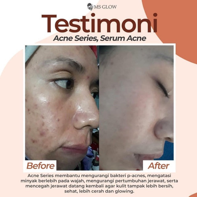 MS GLOW PAKET WAJAH  bonus produk & pouch