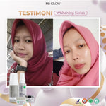 MS GLOW PAKET WAJAH  bonus produk & pouch