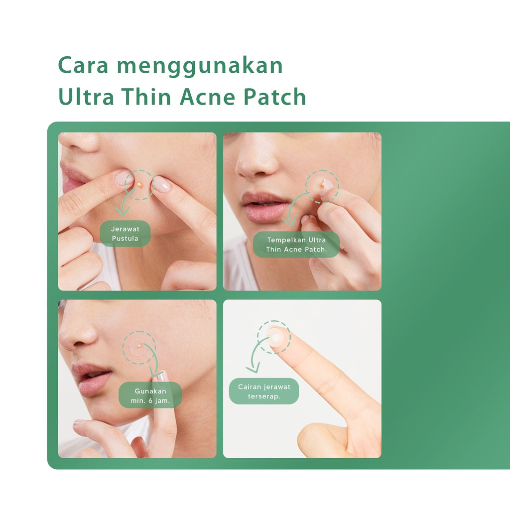 ACNAWAY Ultra Thin Acne Patch – Pimple Patch Tipis untuk Jerawat, Tahan Keringat & Bisa Dipakai di Bawah Makeup | Acne Sticker Salicylic Acid + Tea Tree + Centella Asiatica | Skincare Jerawat Tempel