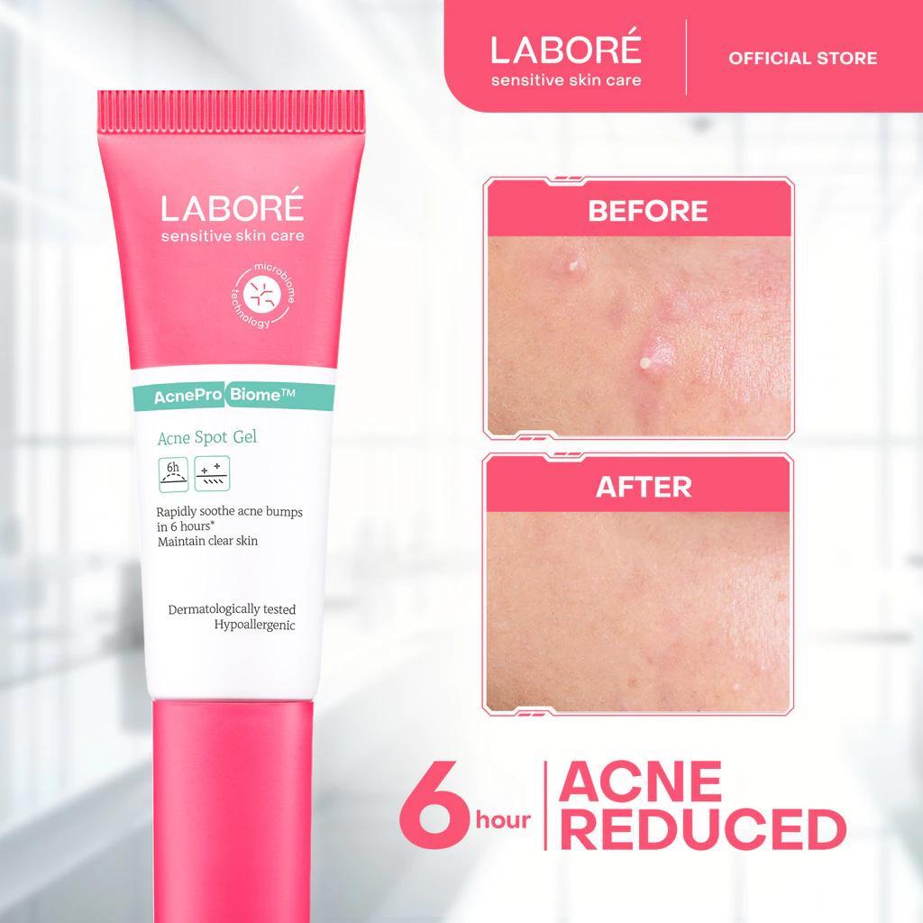 Labore AcnePro Biome Acne Spot Gel 15ml - Facial Treatment for Acne-Prone Skin with Salicylic Acid and Retinol