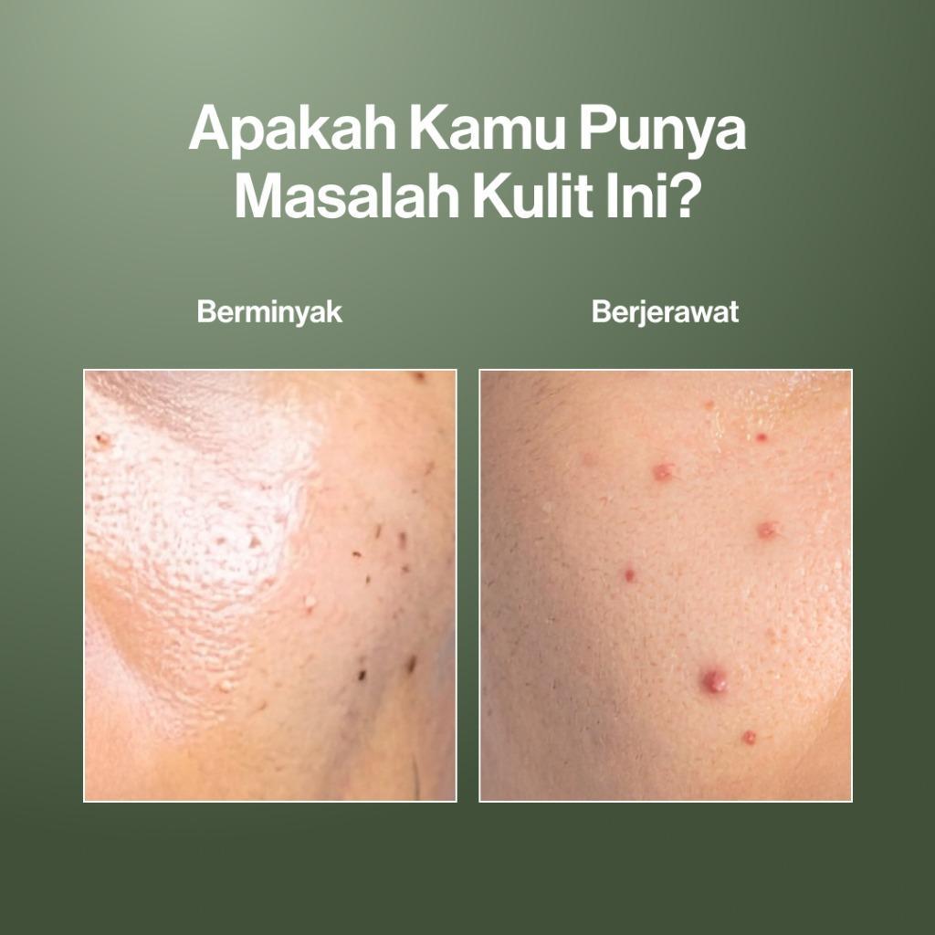 Kahf Face Wash Oil and Acne Care - Anti-Acne & Oil Control for Men with Salicylic Acid Zinc PCA Glycolic Acid & Pentaspan 100ml