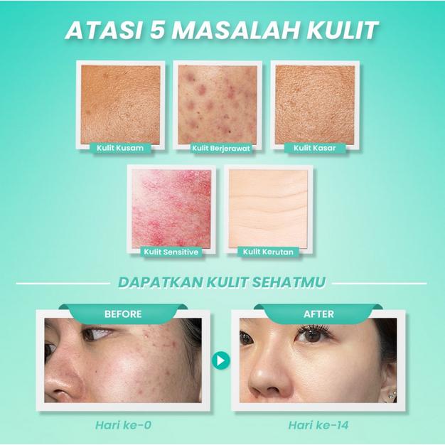 Hanasui Moisturizer Gel 30g – Ceramide Probiotics, Gentle Retinol & Bright Expert for Anti-Aging & Bright Skin