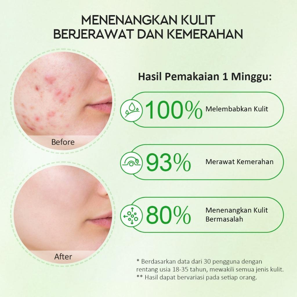 Glad2Glow Centella Allantoin Soothing Gel Moisturizer 55g | Calm, Hydrate & Strengthen Sensitive Skin