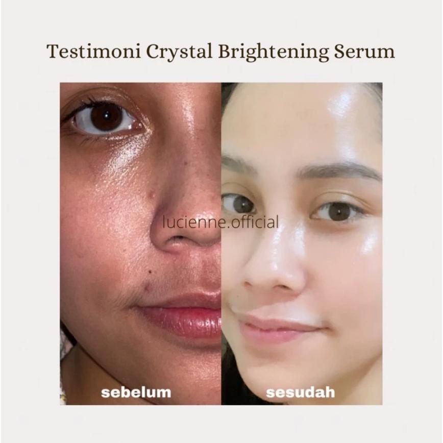 READY STOCK Lucienne Crystal Brightening Serum - Death Store / Glowing Serum / Niacina Series Measure 5% [NEW PLAY] Best Seller