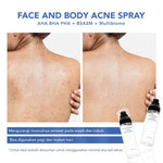 ACNAWAY Acne Face & Body Spray – Face Mist Spray Jerawat untuk Wajah & Badan | Skincare Calming Spray dengan AHA BHA PHA + BSASM + Multibiome | Penghilang Jerawat Punggung, Melembapkan & Menyejukkan Kulit Berjerawat
