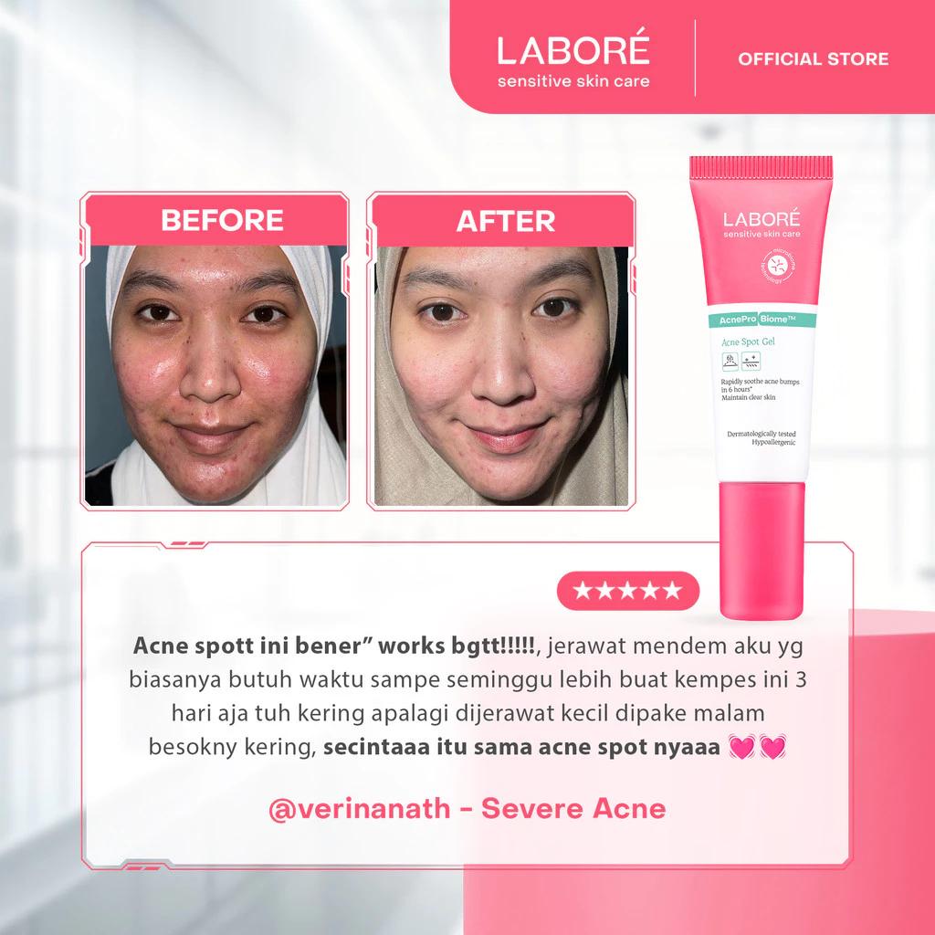Labore AcnePro Biome Acne Spot Gel 15ml - Facial Treatment for Acne-Prone Skin with Salicylic Acid and Retinol