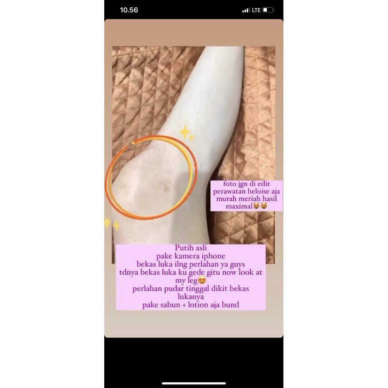 Paket Super Brightening Jerawat punggung & Bekas Luka Heloise Beauty (lotion glow + glow soap collagen) BPOM